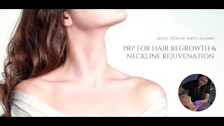 PRP For Hair Neck and Decolletage Rejuvenation [upl. by Mulvihill639]