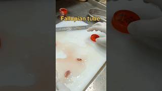 Fallopian tube biopsy sample tissuefixation tissuepreparation biopsy pathology [upl. by Emmott728]