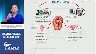 Obstetricia  10 Hemorragia obstetrica II mitad [upl. by Dellora]