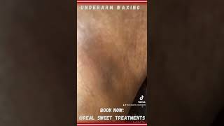 Underarm Waxing waxing armpit underarmwax [upl. by Eilatam]