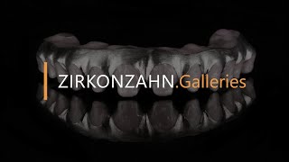 Prettau® 4 Anterior® zirconia on titanium  ZirkonzahnGalleries [upl. by Rosco]