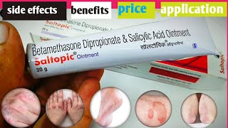 Saltopic Ointment  Betamethasone Dipropionate amp Salicylic Acid Ointment  Saltopic psoriasis [upl. by Laniger]