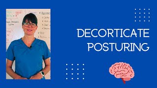 Decorticate Posturing shorts [upl. by Remle]