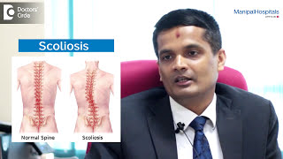 What Is Scoliosis And Its Types  Scoliosis Treatment In India  Scoliosis  Manipal Hospitals [upl. by Apicella]