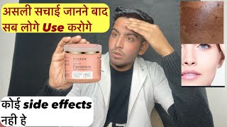 पिग्मेंटेशन को जल्दी ख़त्म करगी क्रीम  nuskhe pigmentation cream  nuskhe by paras prudents review [upl. by Dot797]