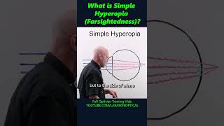 What is simple Hyperopia Farsightedness [upl. by Ailecnarf]