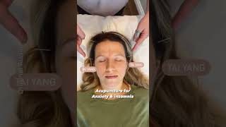 Acupuncture for Anxiety amp Insomnia [upl. by Rafiq]