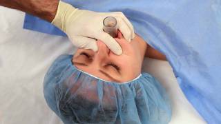 NuMask in Anesthesiology IntraOral Mask IOM®  Oropharyngeal Airway OPA Training Video [upl. by Sievert]