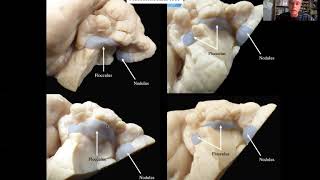 Cerebellum Neuroanatomy of the dog  Lesson 10 [upl. by Levina]