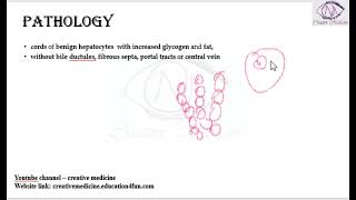 Lec 1 Hepatic Adenoma [upl. by Sturdivant542]