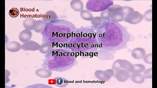 Morphology of Monocyte and Macrophage [upl. by Bagley]