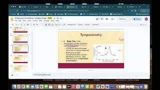 Tympanometry Assignment Module 4 [upl. by Ilahsiav]