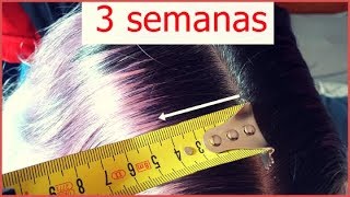 Cómo acelerar el crecimiento del cabello ¡¡ HASTA 4 CM EN 3 SEMANAS [upl. by Fletcher]