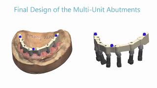 3Shape Dental System  How to Use Multi Unit Abutments [upl. by Llewkcor]