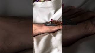 Indirect moxibustion technique on LR3 [upl. by Eliezer616]