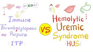 Immune Thrombocytopenia ITP vs Hemolytic Uremic Syndrome HUS [upl. by Oflodur]