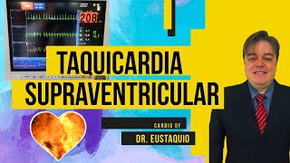 TAQUICARDIA SUPRAVENTRICULAR O Que É É Grave  Dr Eustáquio Ferreira Neto [upl. by Martino]