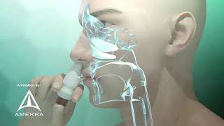 Fluticasone nasal spray Flonase  3D medical animation [upl. by Ailegnave]