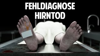 Fehldiagnose Hirntod Wann ist der Mensch wirklich tot [upl. by Olnek193]