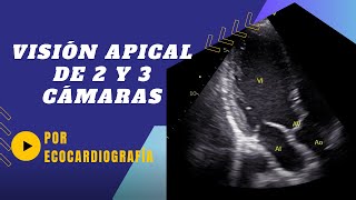 ✅Cómo obtener VISIÓN APICAL DE 2 y 3 CÁMARAS POR ECOCARDIOGRAFÍA 💪Guía paso a paso [upl. by Kelwin639]