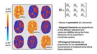 37 Diffusion 1 DTI Basic Principles Diff E2 [upl. by Ocin]