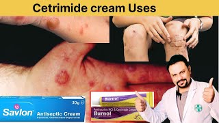 Uses of Cetrimide creamsavloncreamburnloncream [upl. by Shirline]