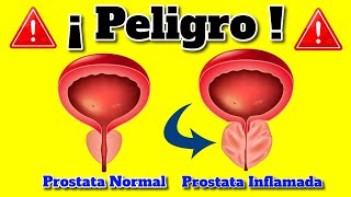 Como DESINFLAMAR la PROSTATA INFLAMADA  Prostatitis Remedios Caseros Tratamiento Natural 2024 [upl. by Pudens519]