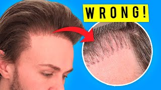 7 Reasons Why Hair Transplants Fail [upl. by Ainoda]