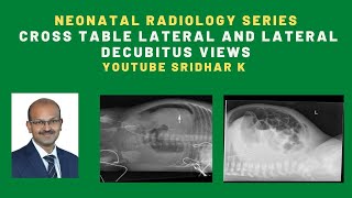 Neonatal radiology serieswhen do we use cross table lateral view and lateral decubitus view xray [upl. by Benzel]