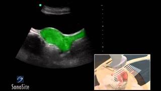 How To Female Pelvis Ultrasound Exam 3D Video [upl. by Ilera]