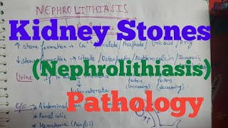 Kidney Stones  Nephrolithiasis Pathology [upl. by Ledua969]