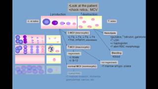 Anemia differential diagnosis [upl. by Nora277]