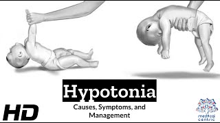 Hypotonia Explained What You Need to Know [upl. by Akerdna]