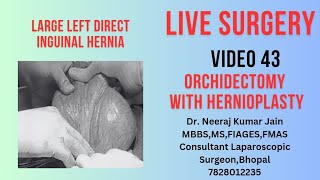 LARGE DIRECT INGUINAL HERNIA DEFECT MORE THAN 7CM HERNIOPLASTY WITH ORCHIDECTOMY [upl. by Tisbee]