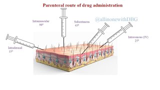 Parenteral routePart 2Routes of Drug administration pharmacology pharmacy [upl. by Carpet]