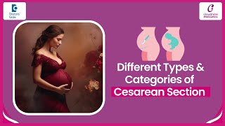 Types of Cesarean or CSection delivery  DrVinatha Puli at Cloudnine Hospitals  Doctors Circle [upl. by Biddy]