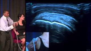 Dr Don Buford Live 13 Point Shoulder Ultrasound Exam Demo [upl. by Berkow229]