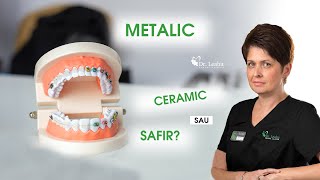 Metalic ceramic sau safir Ce aparat dentar fix este mai bun  Clinicile Dentare Dr Leahu [upl. by Magill]