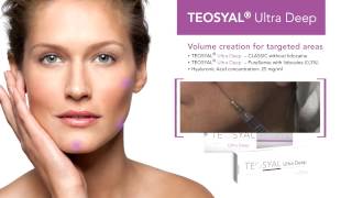 Lip and Cheek fillers with TEOSYAL® dermal filler range [upl. by Ahsini]