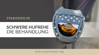 Schwere Hufrehe Hauptfilm – Hufrehe Hufbeinsenkung Ausschuhen – die Behandlung [upl. by Auoy]