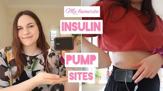 My favourite insulin pump sites  Tandem tslim x2 infusion sites and cannula options [upl. by Galasyn]