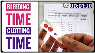 BT CT Test  Bleeding Time AND Clotting Time Coagulation Time Blood Test [upl. by Oriaj]