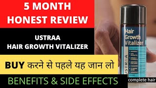 जानिए पूरा सच  Ustraa Hair Growth Vitalizer 100 Real 5 Month use review  BIG FIT [upl. by Eugor]