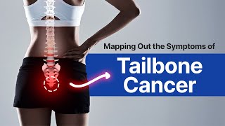 Mapping Out the Symptoms of Tailbone Cancer  iCliniq [upl. by Letsyrk]