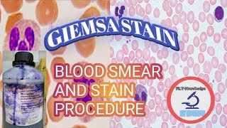 BLOOD SMEAR amp GIEMSA STAIN PROCEDURE [upl. by Ecnaret]