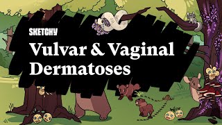 Vulvar amp Vaginal Dermatoses Full Lesson  Sketchy Medical  USMLE Step 2 CK [upl. by Zoe944]