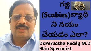 How to cure and control Scabies [upl. by Fenn]