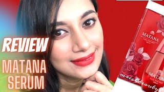 Matana Rose Drop Serum ReviewMarketing Strategy behind Matana Serum Matanaserum Sajiablog [upl. by Acila648]