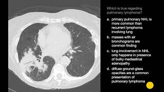 Radiology of Lung Cancer amp Other Neoplasm  Carcinoid Tumor  Adenocarcinoma  Hamartoma  Lymphoma [upl. by Rhyne]