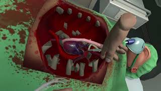 Surgeon SImulator VR [upl. by Morry]